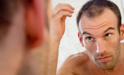 Hairstyles For Balding Men-1318